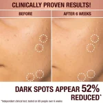 سرم ضد لک و روشن‌کننده شارلوت تیلبری | Charlotte Tilbury Dark Spot Correcting Radiance Recovery Serum - Image 4